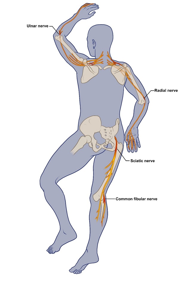 post-covid-19-nerve-damage-rehabilitation-highlighted-in-nyt